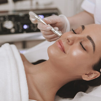 microdermabrasion